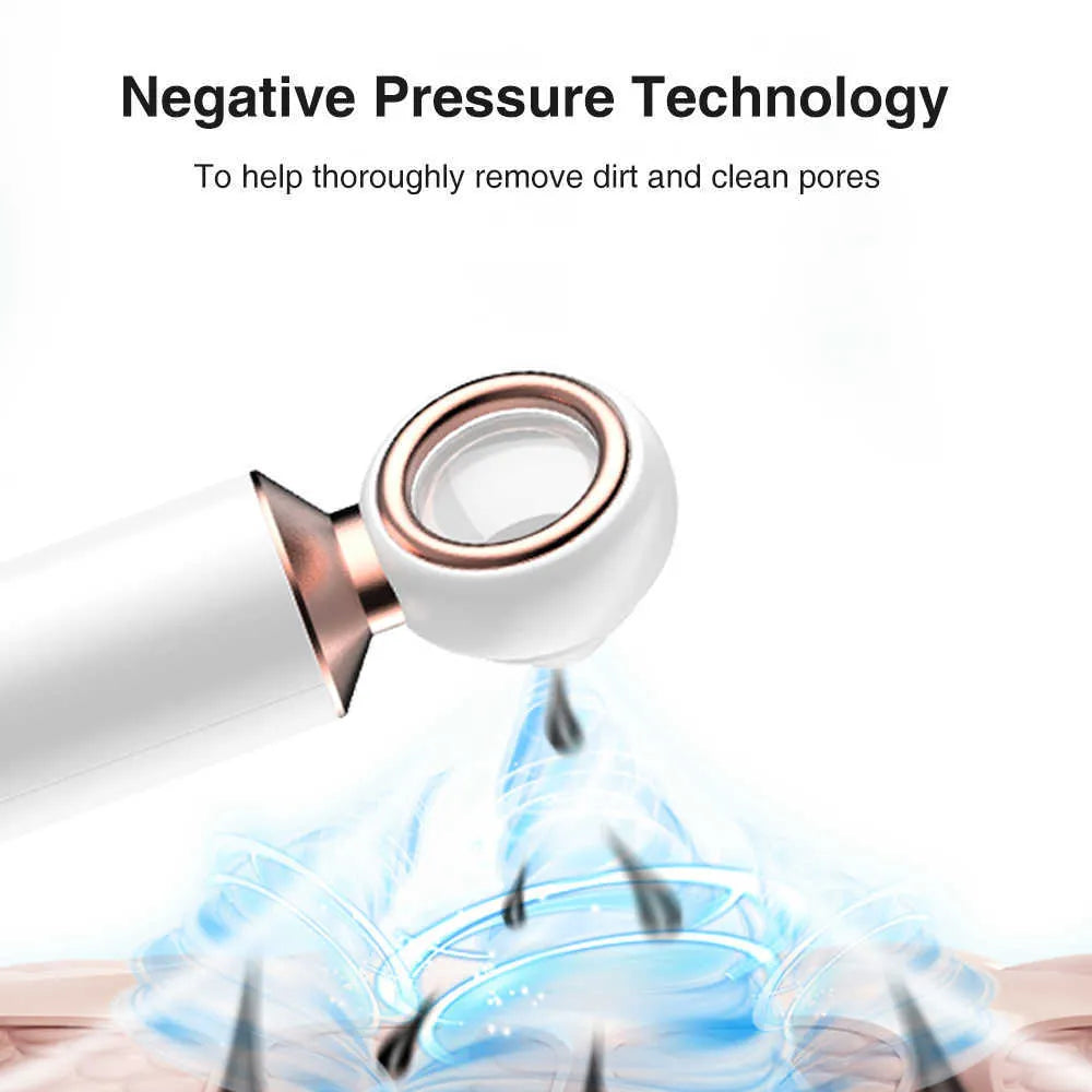 Bizzy Mart™ Blackhead Suction Machine
