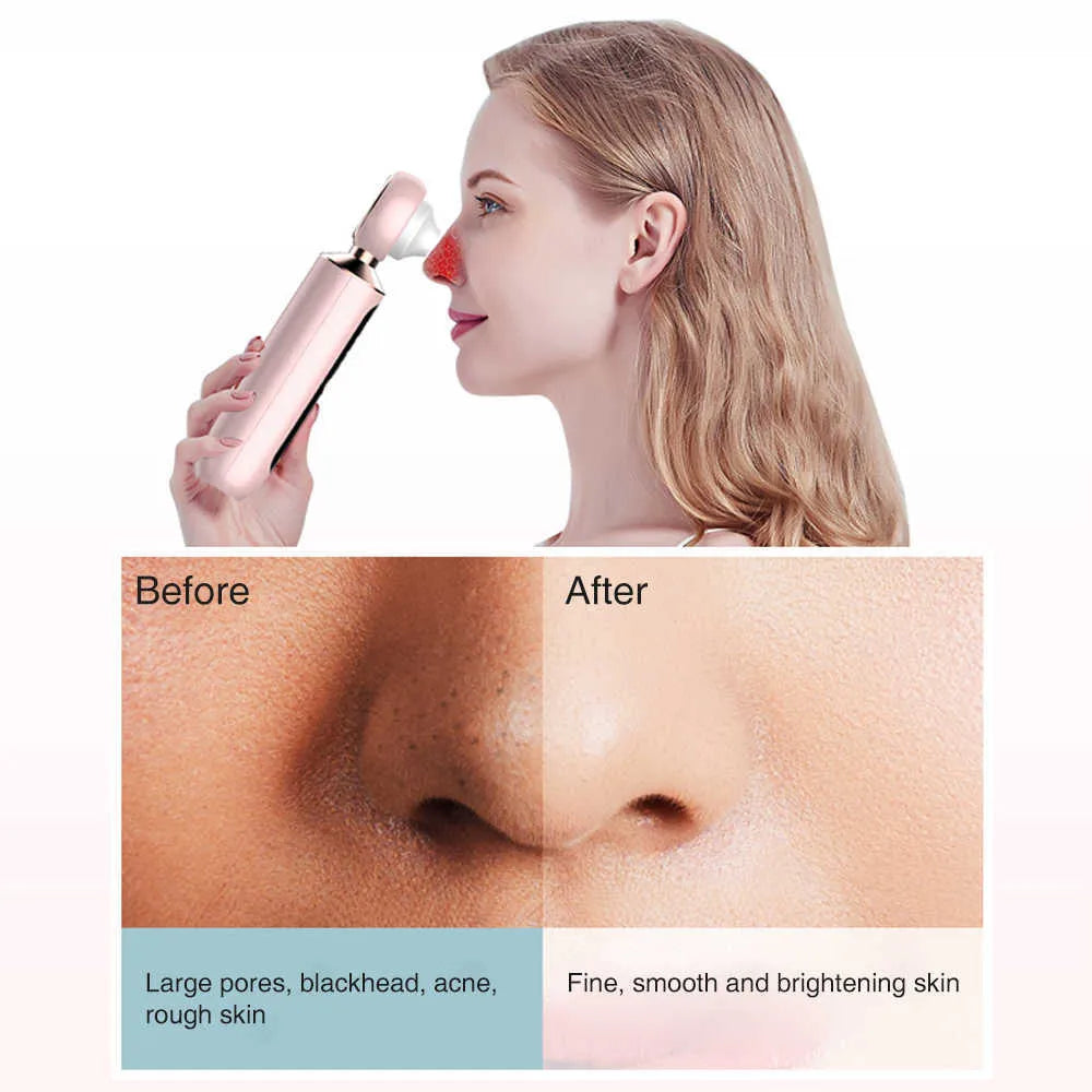 Bizzy Mart™ Blackhead Suction Machine