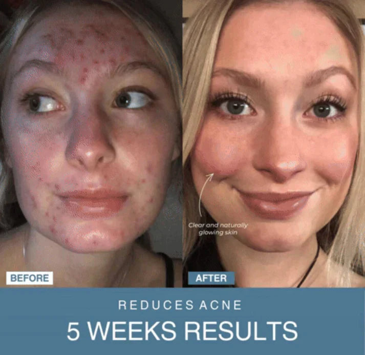 Bizzy Mart™ 7-in-1 LED Anti-Aging/Wrinkle Apparatus