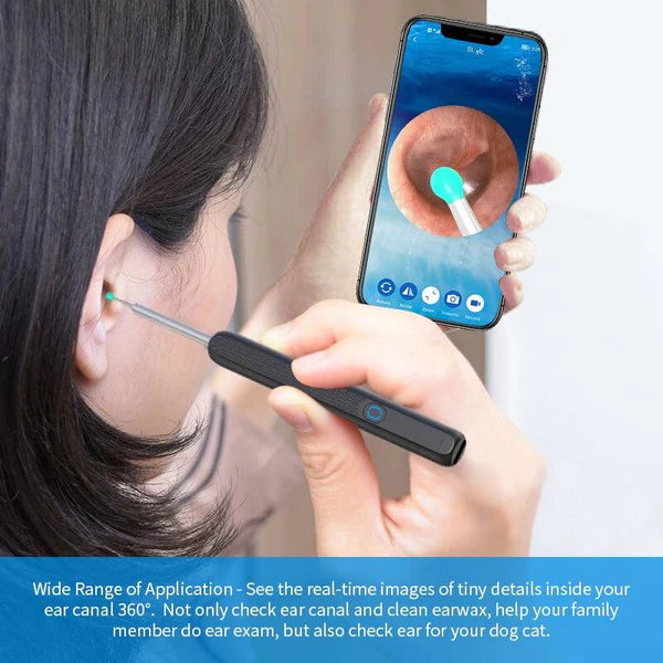 Bizzy Mart™Smart Ear Cleaning Device