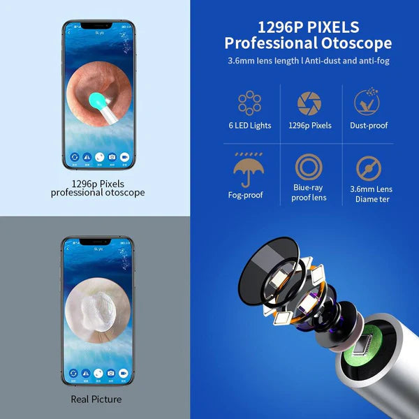 Bizzy Mart™Smart Ear Cleaning Device
