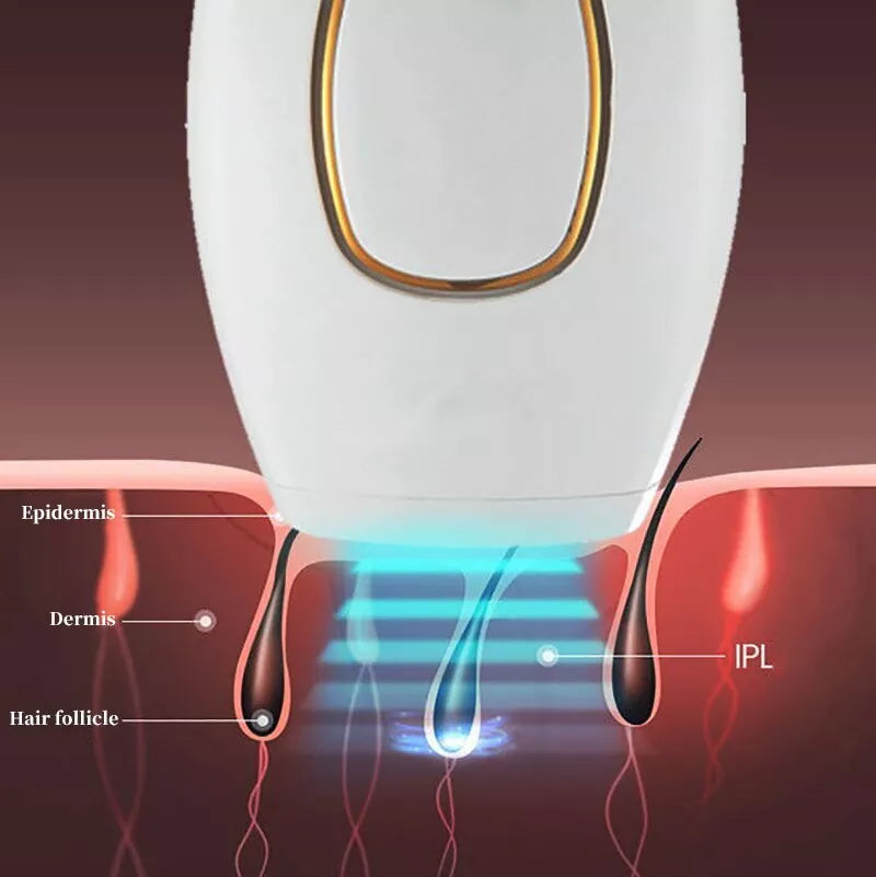 Bizzy Mart™ IPL Laser Hair Removal – جهاز إزالة الشعر بالليزر IPL