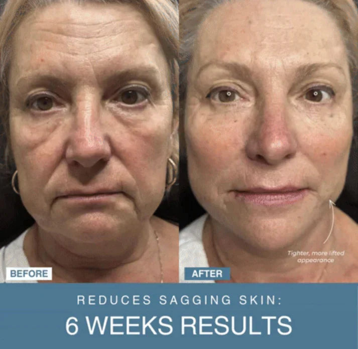 Bizzy Mart™ 7-in-1 LED Anti-Aging/Wrinkle Apparatus